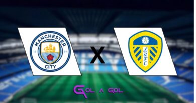 Manchester City x Leeds